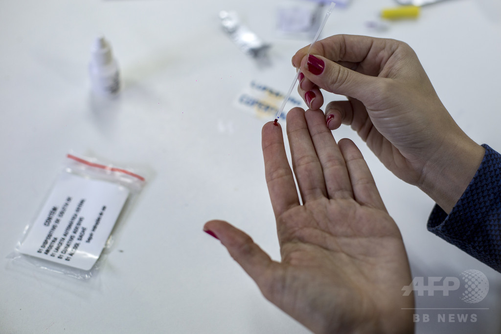 中南米で女性と同性愛者のHIV感染拡大、背景に暴力と差別 国連 中南米で女性と同性愛者のHIV感染拡大、背景に暴力と差別 国連