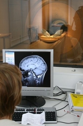 脳の活動阻害で道徳的判断に異常、米研究