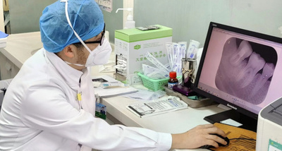 中国の医師 欠損歯の代わりに親知らずを巧みに使用