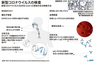 【図解】新型コロナ感染の検査方法とウイルスの構造