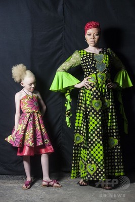 アルビノであることに誇りを、コンゴで啓発ファッションショー
