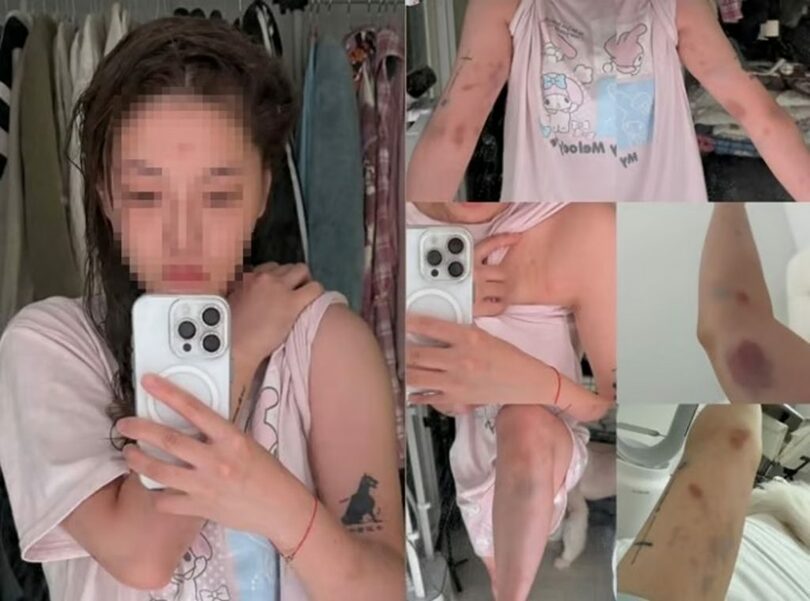 被害女性SNS(c)MONEYTODAY