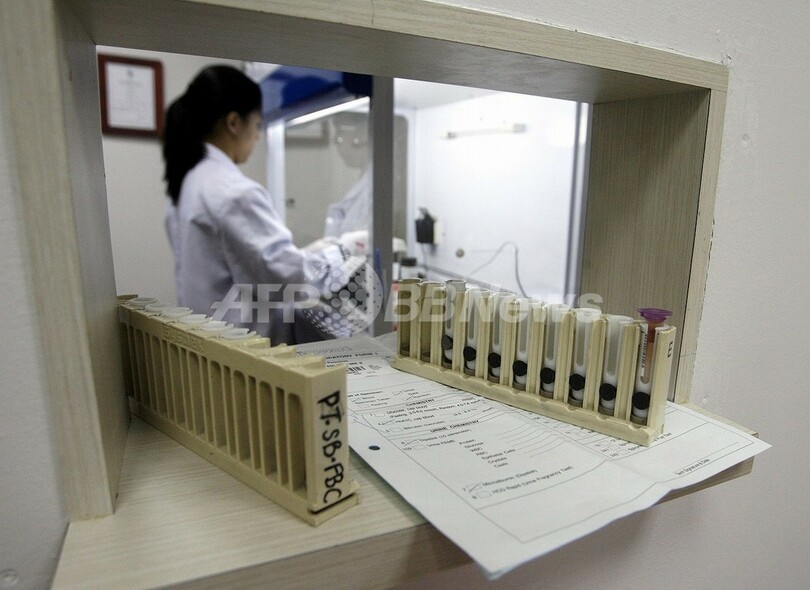 がんや心疾患の診断に唾液利用が可能に?米研究報告