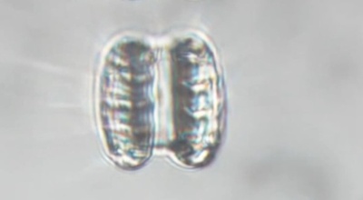 マイクロナノロボットが「ナノ医師飲み込み治療」を実現