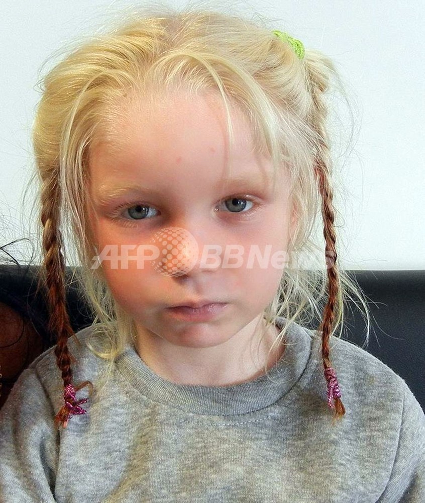 保護された 金髪の少女 先天性色素欠乏症の可能性 写真2枚 国際ニュース Afpbb News