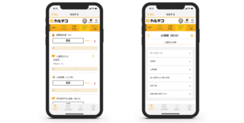 カルテコで「心電図」・「酸素飽和度」閲覧可能に Apple「ヘルスケア」との連携項目追加