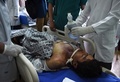 アフガニスタンの首都カブールで発生した爆発で負傷し、病院で治療を受ける人（2017年5月3日撮影）。(c)AFP/WAKIL KOHSAR