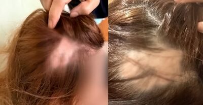 女子高校生の口論が暴力事件に発展…韓国・加害生徒の両親が介入、警察沙汰に