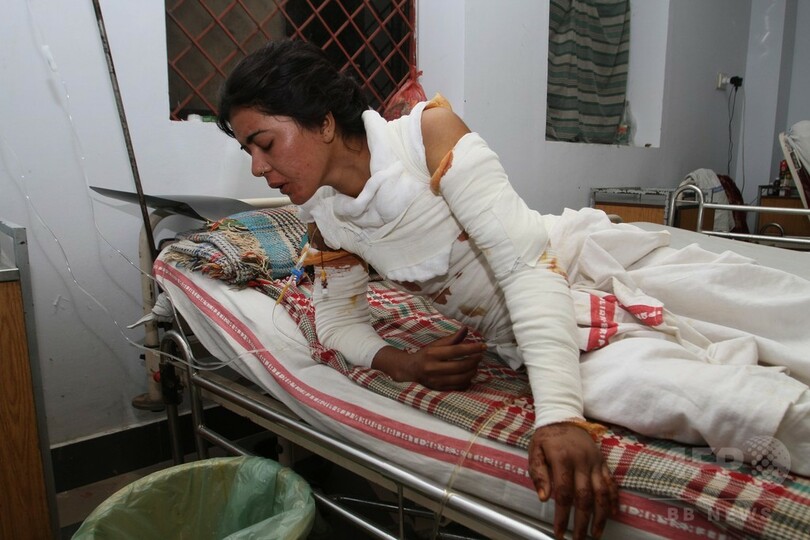 「求婚断り火付けられた」女性が死亡、パキスタン