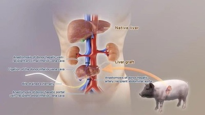 中国の研究チーム ゲノム編集されたブタの肝臓の人体への移植に成功
