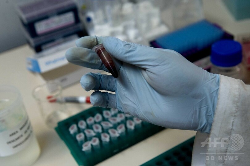 がんや多発性硬化症など検知、血液検査の研究進む