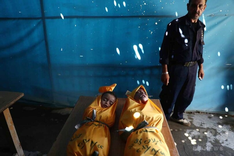 【AFP記者コラム】シリア最大の被害者は子どもたち、無数にいる「オムラン君」