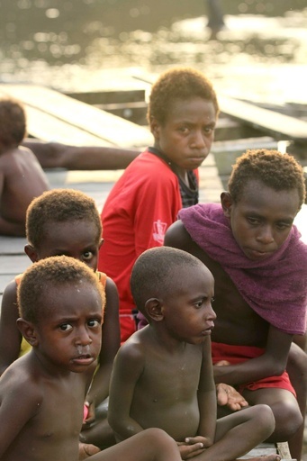 インドネシア最東州、栄養失調とはしかで幼児69人死亡