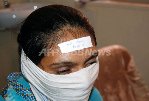インドでhiv陽性の女性の額にステッカー 医師が謝罪 写真2枚 ファッション ニュースならmode Press Powered By Afpbb News インドでhiv陽性の女性の額にステッカー 医師が謝罪 写真2枚 ファッション ニュースならmode Press Powered By Afpbb News