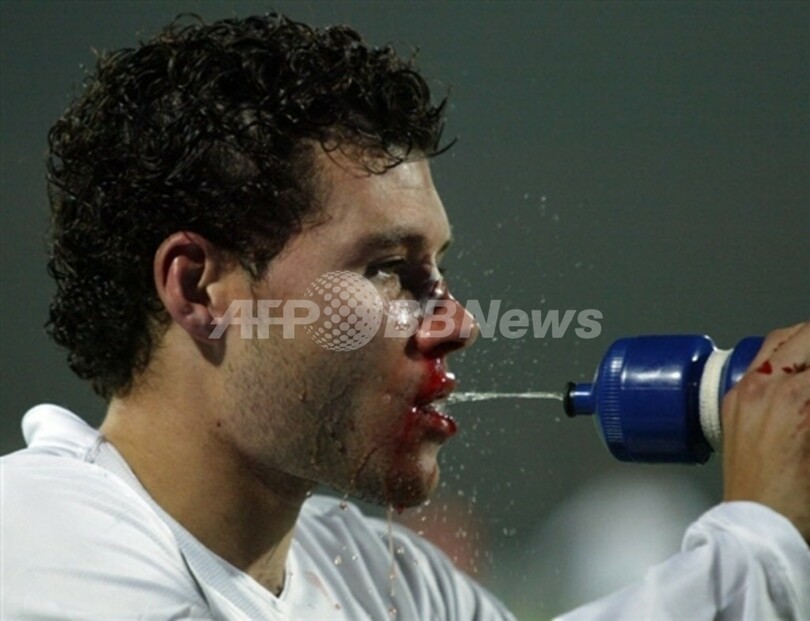 <サッカー 欧州チャンピオンズリーグ>ナバッロ 7ヶ月の出場停止処分に スイス 写真1枚 国際ニュース:AFPBB News