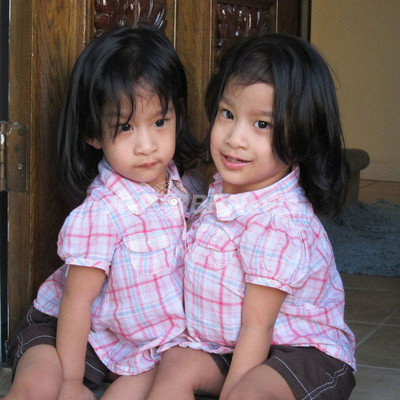 フィリピンの結合双生児 米国で分離手術へ 写真2枚 国際ニュース Afpbb News