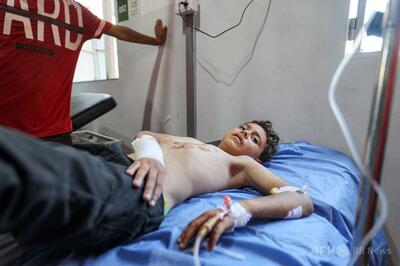 WHO、より多くの国にガザ患者の受け入れ要請