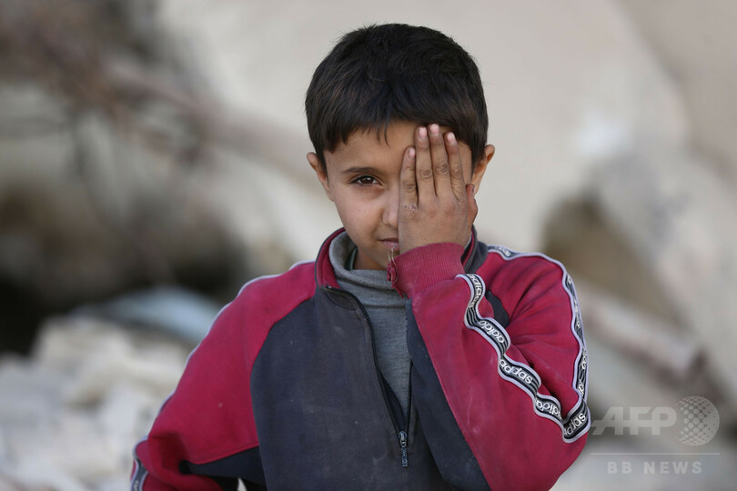 シリア空爆で片目失った赤ちゃん、包囲戦への抗議のシンボルに