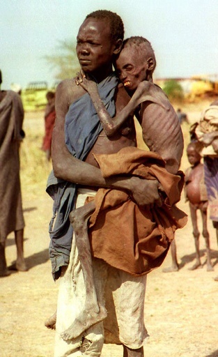 「飢餓に苦しむ子供」　