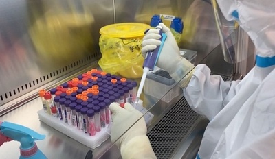 中国のPCR検査試薬 オミクロン株にも有効