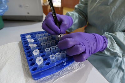 便サンプルの提供希望者が殺到、公募を中止 仏パリの病院