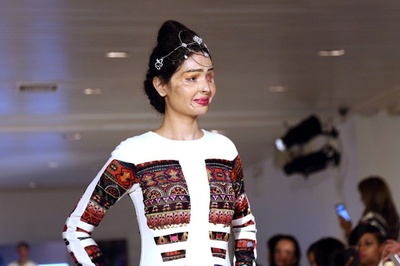 酸攻撃の被害女性、ファッションウイークのランウェイに 米NY