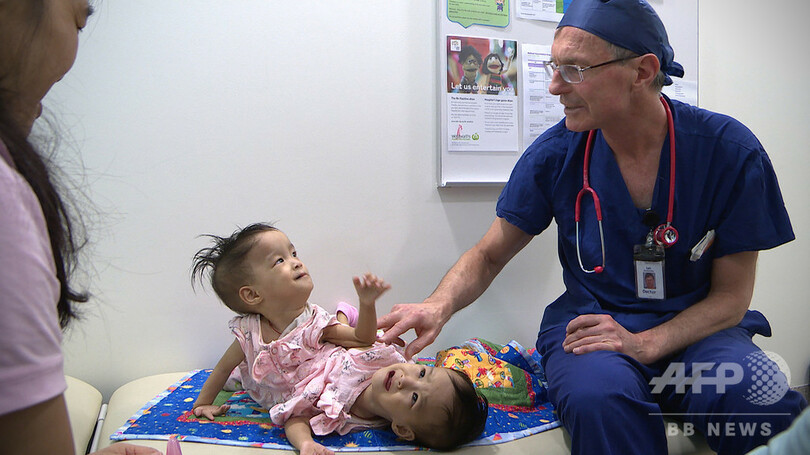 ブータンの結合双生児 分離手術後も同じベッドで順調に回復 豪 写真8枚 国際ニュース Afpbb News