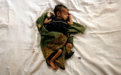 経済成長続くインド、依然深刻な栄養失調