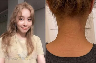 韓流ミュージカル女優の首を貫通した「2本の針」