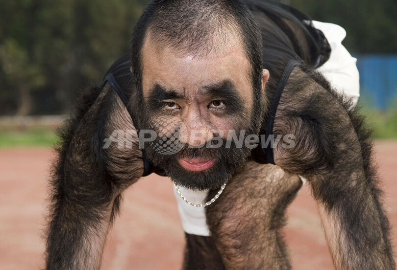 「中国で最も毛深い男」、北京五輪聖火リレー走者に立候補