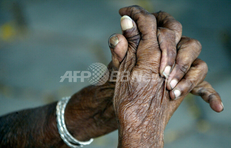 世界最高齢者の125歳女性生存か、トルコ