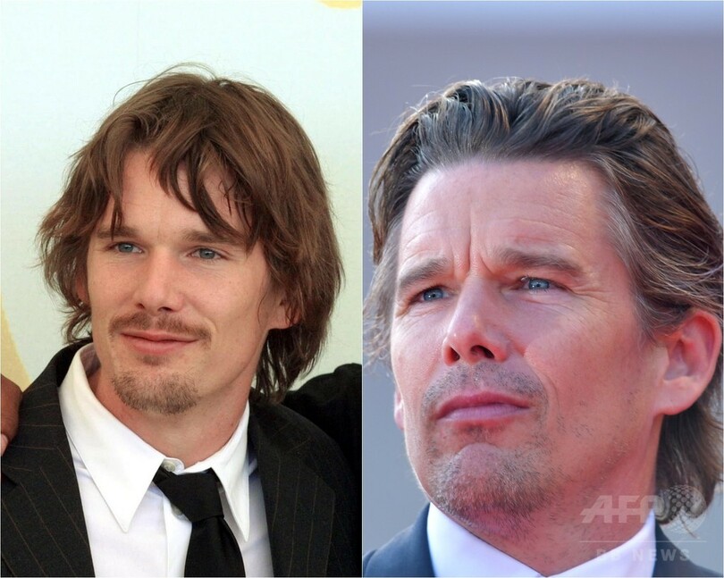 【写真特集】海外男性セレブのビフォーアフター