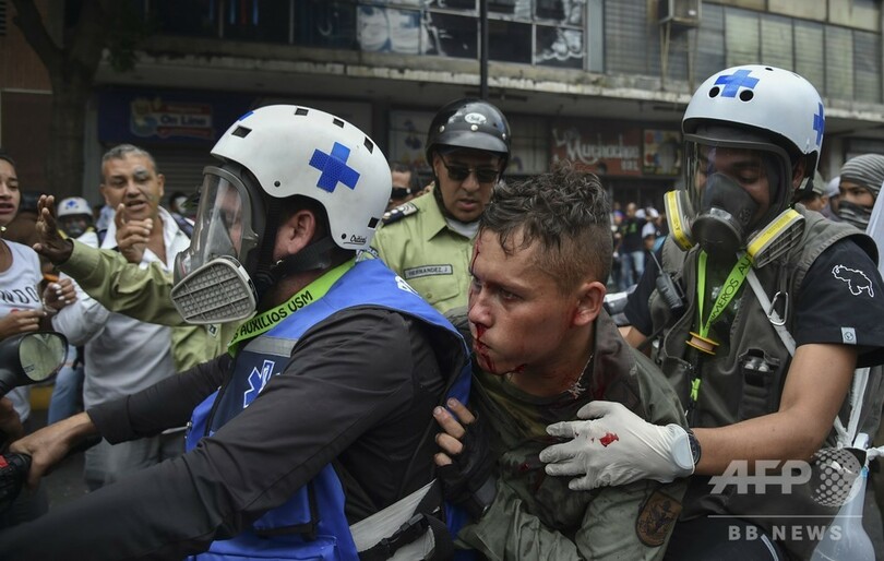 ベネズエラ野党指導者が「暫定大統領」宣言 米国など支持表明