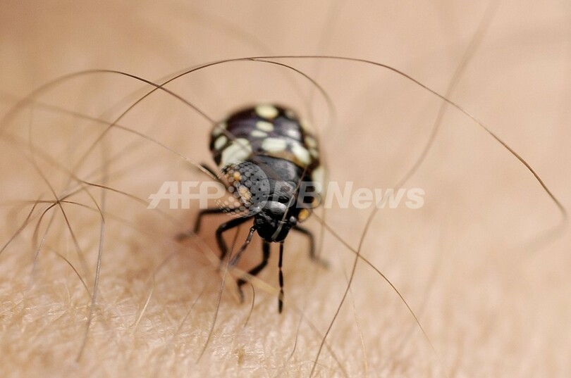 フェリーで一晩過ごしたイタリア人女性 ダニまみれの 悪夢 写真1枚 国際ニュース afpbb news