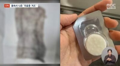 体内に手のひら大のガーゼ放置…韓国の産婦人科で起きた医療事故、医師の「嫌疑なし」に怒りの声