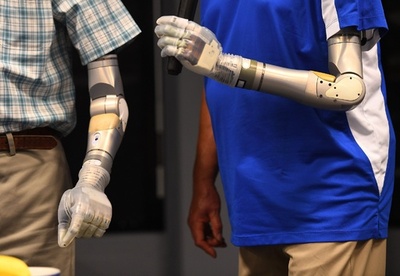 最先端の義肢「ルーク・アーム」販売へ 米国防総省開発