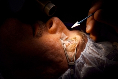 息子の歯で人工角膜移植、アイルランド男性が視力回復