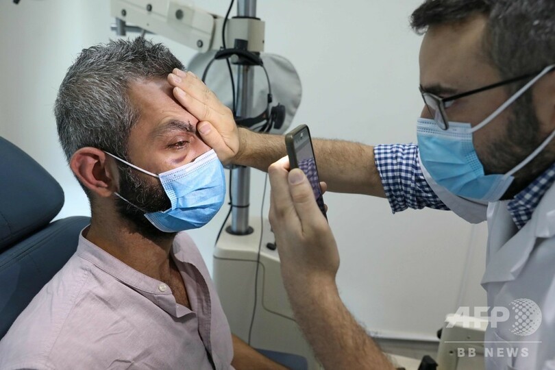 「どん底から見る世界」 ベイルート大爆発で失った片目