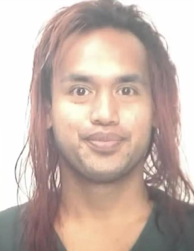 ハワイで25歳中国人女性 化学液体かけられ大やけど