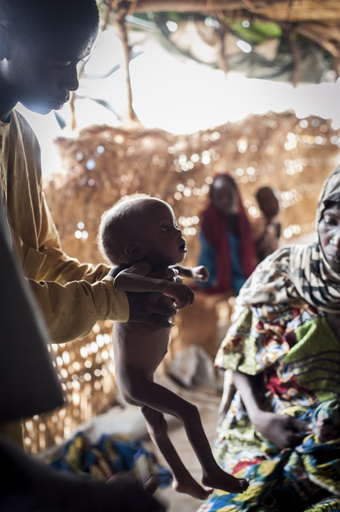 ナイジェリアの子ども7万5000人、数か月内に死亡の危機 国連