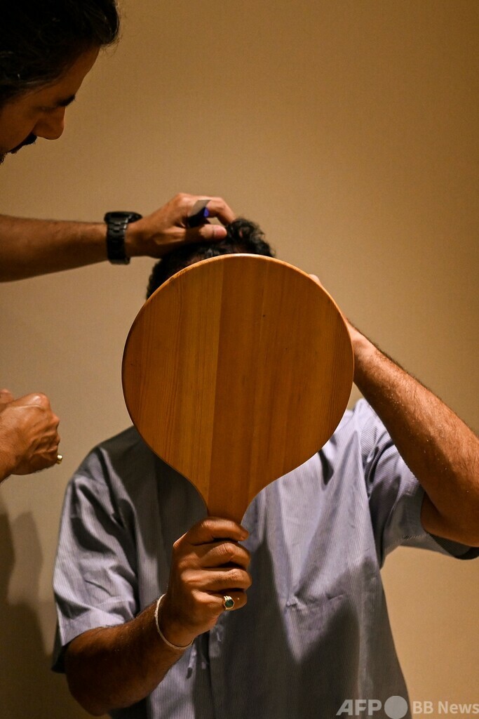 植毛手術後に死亡、YouTubeで独学の素人施術が横行 インド