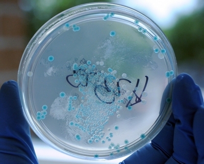 欧州の大腸菌感染で新たな死者、スペイン産キュウリの警告は撤回