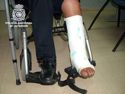 骨折した足にコカイン製ギプス、チリ人の男を逮捕 スペイン・バルセロナ