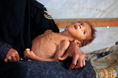 数百万人の飢餓リスク、コロナ禍と気候変動で悪化 国連事務総長