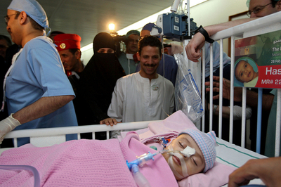 エジプトの結合双生児、サウジで分離手術に成功