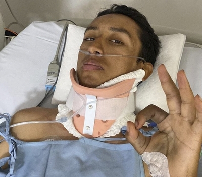 バス追突で重傷のベルナル、障害は残らないと明かす