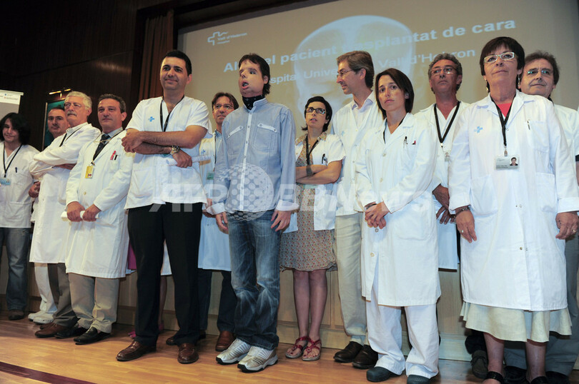 世界初の顔面完全移植男性、TV記者会見で感謝の言葉 スペイン