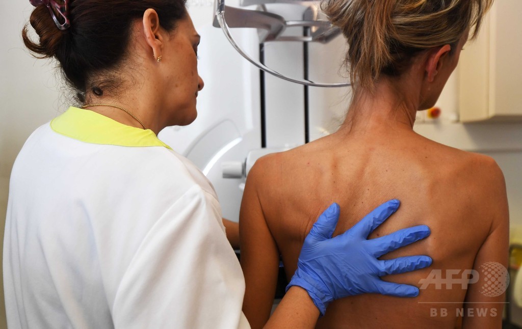 乳がん細胞の休眠、仕組みを解明 米研究 乳がん細胞の休眠、仕組みを解明 米研究