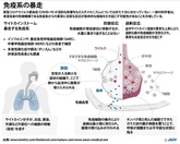 新型コロナ、ウイルス感染で免疫系が過剰反応 命の危険も