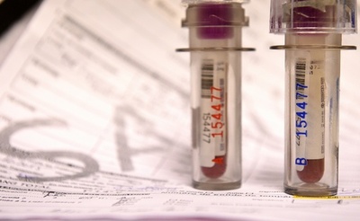 WADA、RUSADAの資格回復に向けたモスクワ訪問を終了